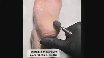 Колпачки для педикюра МедКапс